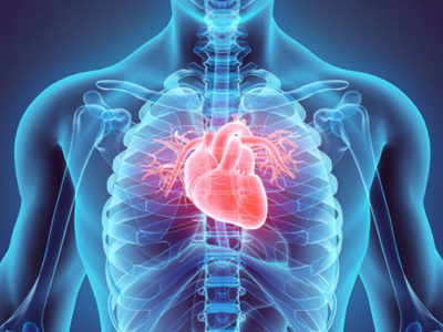 Infarctus du myocarde