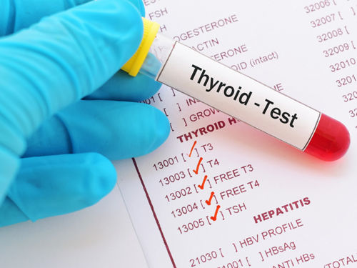 Maladie de la thyroïde